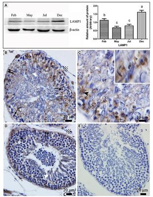 Entosis Acts as a Novel Way within Sertoli Cells to Eliminate Spermatozoa in <mark class="highlighted">Seminiferous Tubule</mark>